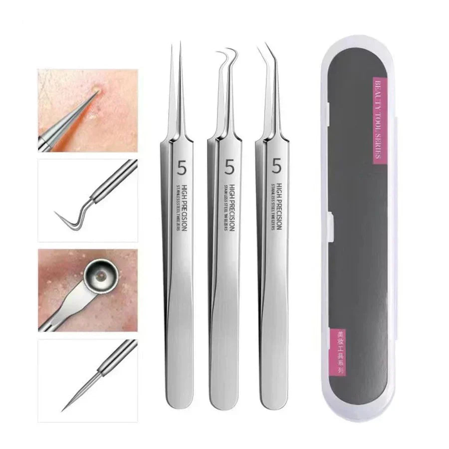 Aurella 3-Piece Stainless Steel Blackhead Tweezer Set, Boxed