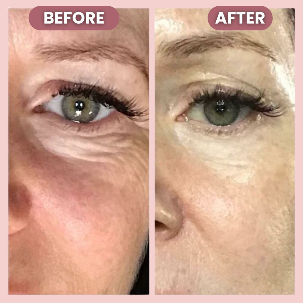 RadiantLift Eye Cream | Brighten, Lift & Smooth for Youthful Eyes | Fioriscas