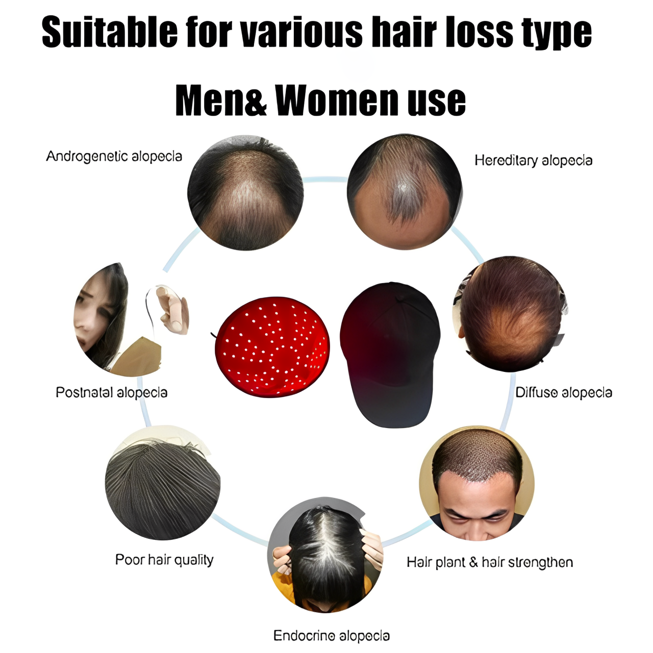 Cuffia laser per la crescita dei capelli con luce rossa e infrarossa, per uso domestico