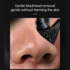 Deluxe Stainless Steel Pore & Blackhead Extractor Tool Kit