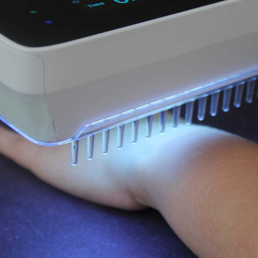 AureaBeam Portable UVB Light Therapy Lamp for Home Use