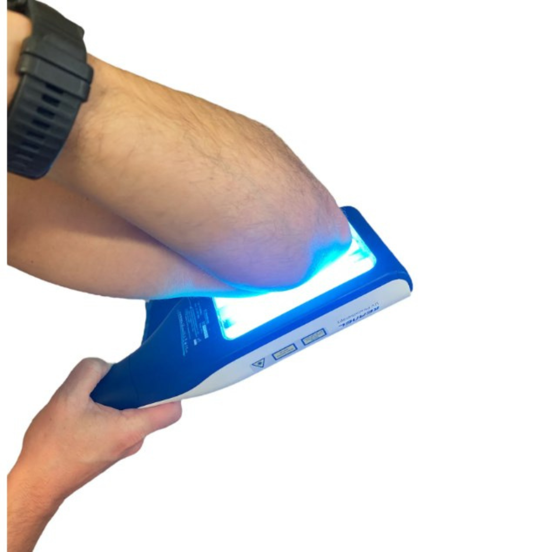 Přenosná UVB lampa DermaLuma pro každodenní domácí použití