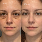 Advanced Dual-Tech Eye Revitalizer With Red Light Therapy And EMS