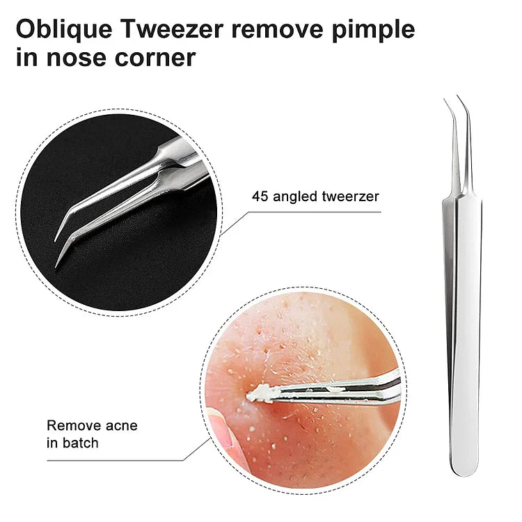Aurella 3-Piece Stainless Steel Blackhead Tweezer Set, Boxed