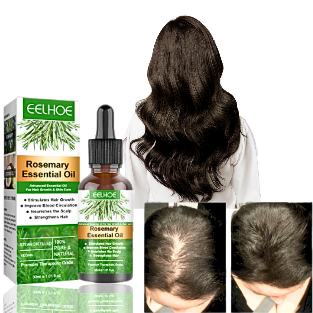 Rosemary Oil Supports Hair Growth And Refreshes Scalp | Fioriscas