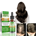 Rosemary Oil Supports Hair Growth And Refreshes Scalp | Fioriscas