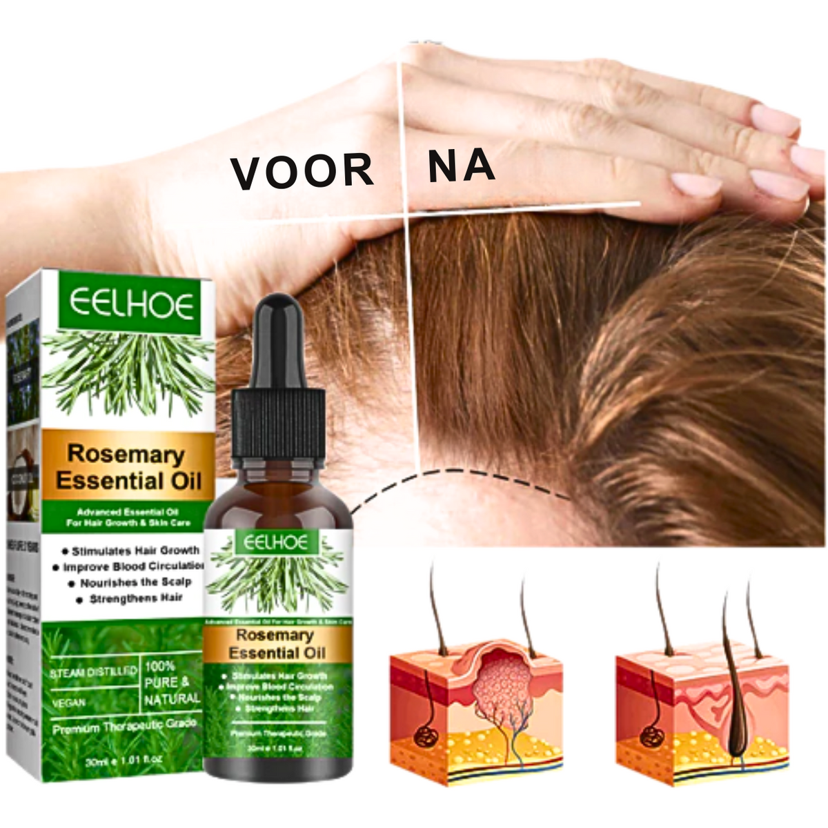 Rosemary Oil Supports Hair Growth And Refreshes Scalp | Fioriscas