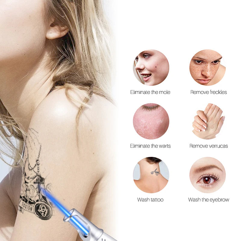 AstraGlow Pocket Laser Pen Freckles Tattoos And Moles