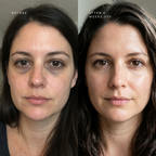 Advanced Dual-Tech Eye Revitalizer With Red Light Therapy And EMS