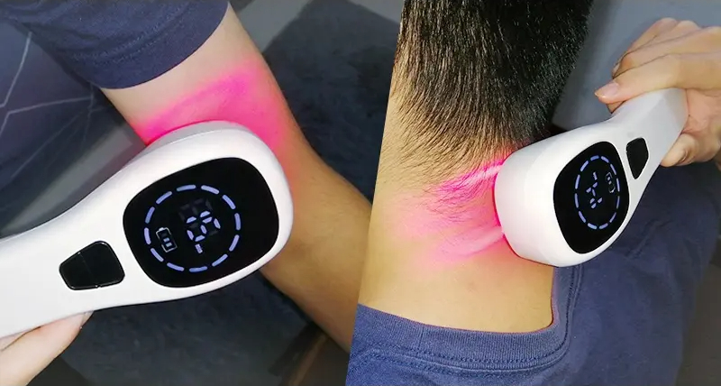 Soulagement des douleurs à domicile avec appareil laser froid à double longueur d’onde amélioré | Fioriscas