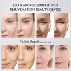 Six In One LED Skin Renewal Tool For Radiant Complexion | Fioriscas