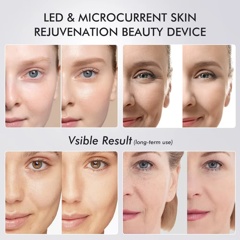 Six In One LED Skin Renewal Tool For Radiant Complexion | Fioriscas
