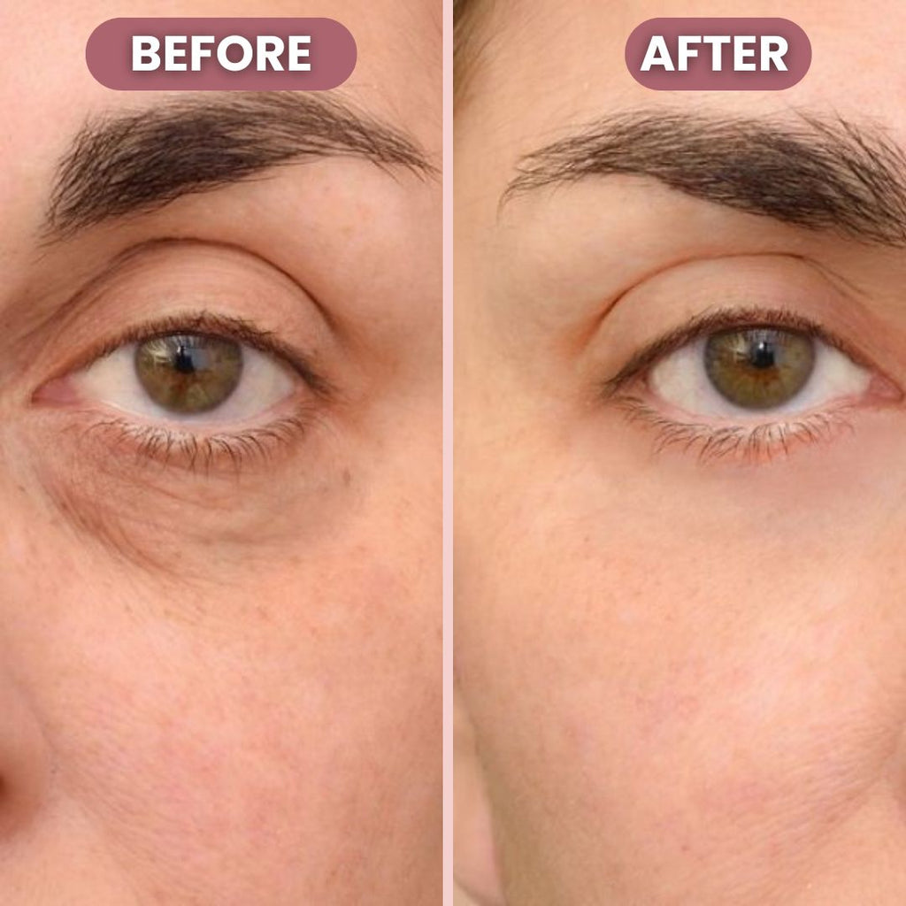 RadiantLift Eye Cream | Brighten, Lift & Smooth for Youthful Eyes | Fioriscas