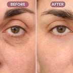 RadiantLift Eye Cream | Brighten, Lift & Smooth for Youthful Eyes | Fioriscas