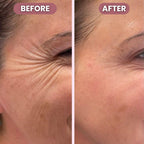 RadiantLift Eye Cream | Brighten, Lift & Smooth for Youthful Eyes | Fioriscas