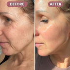 RadiantLift Eye Cream | Brighten, Lift & Smooth for Youthful Eyes | Fioriscas