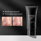 Deluxe Stainless Steel Pore & Blackhead Extractor Tool Kit