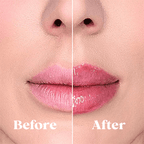 Conjunto LustraGlow Lip Plumper para Lábios Mais Cheios e Aparência Mais Suave | Fioriscas