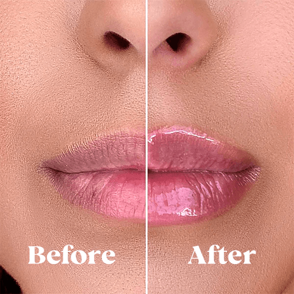 Conjunto LustraGlow Lip Plumper para Lábios Mais Cheios e Aparência Mais Suave | Fioriscas