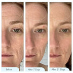 Bio-Collagen Hydrating Sheet Mask By Aurelia Glow For Glowing Skin