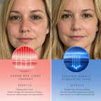 Advanced Dual-Tech Eye Revitalizer With Red Light Therapy And EMS