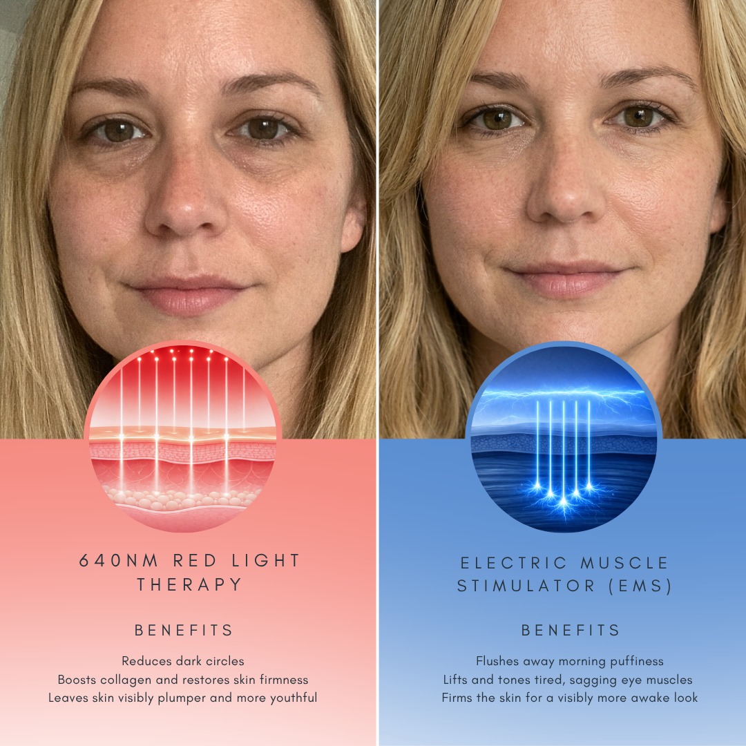 Advanced Dual-Tech Eye Revitalizer With Red Light Therapy And EMS