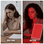 لوحة LuminaDeep للعلاج بالضوء الأحمر | علاج الكولاجين والتعافي في المنزل لمدة 10 دقائق | Fioriscas