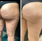 Óleo corporal intensivo SilkSculpt anticelulite e alisador da pele | Fioriscas