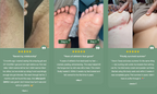 غسول جسم مضاد للفطريات للعناية بالبشرة الفطرية | فيوريسكاس