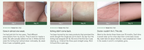 Antifungal rensebar til irriteret hud | Fioriscas