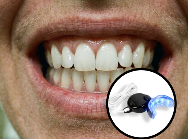 LED Teeth Whitening Device for a Brighter Smile | Fioriscas