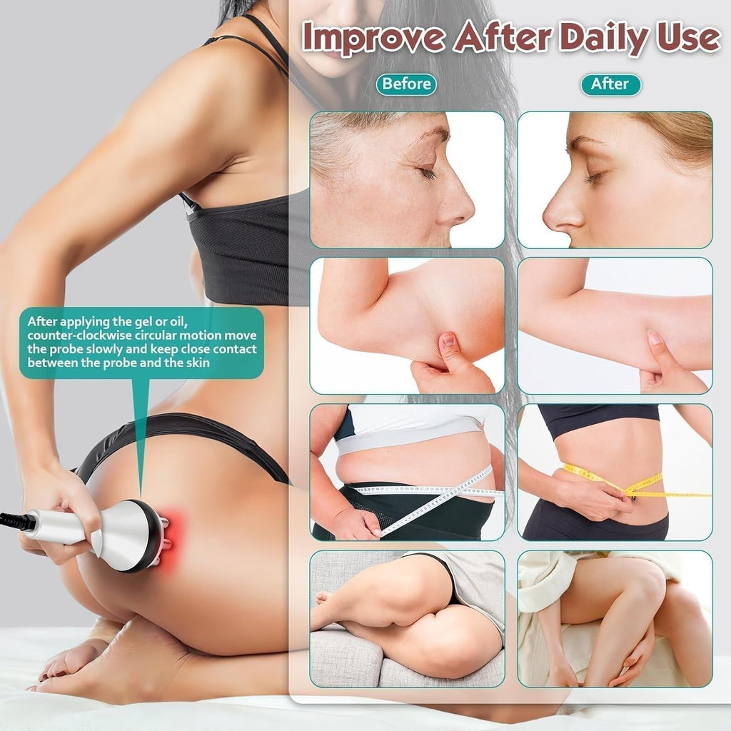 Home Ultrasonic Cavitation And RF Slimming Device For Fat Reduction And Tightening | Fioriscas