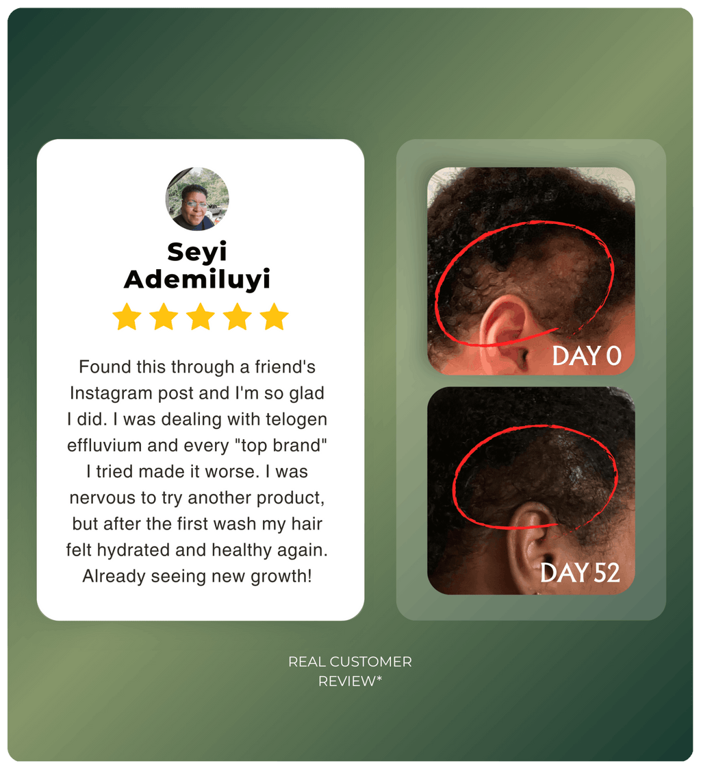 Authentic Hand-Extracted Batana Oil For Scalp Care and Nourishment