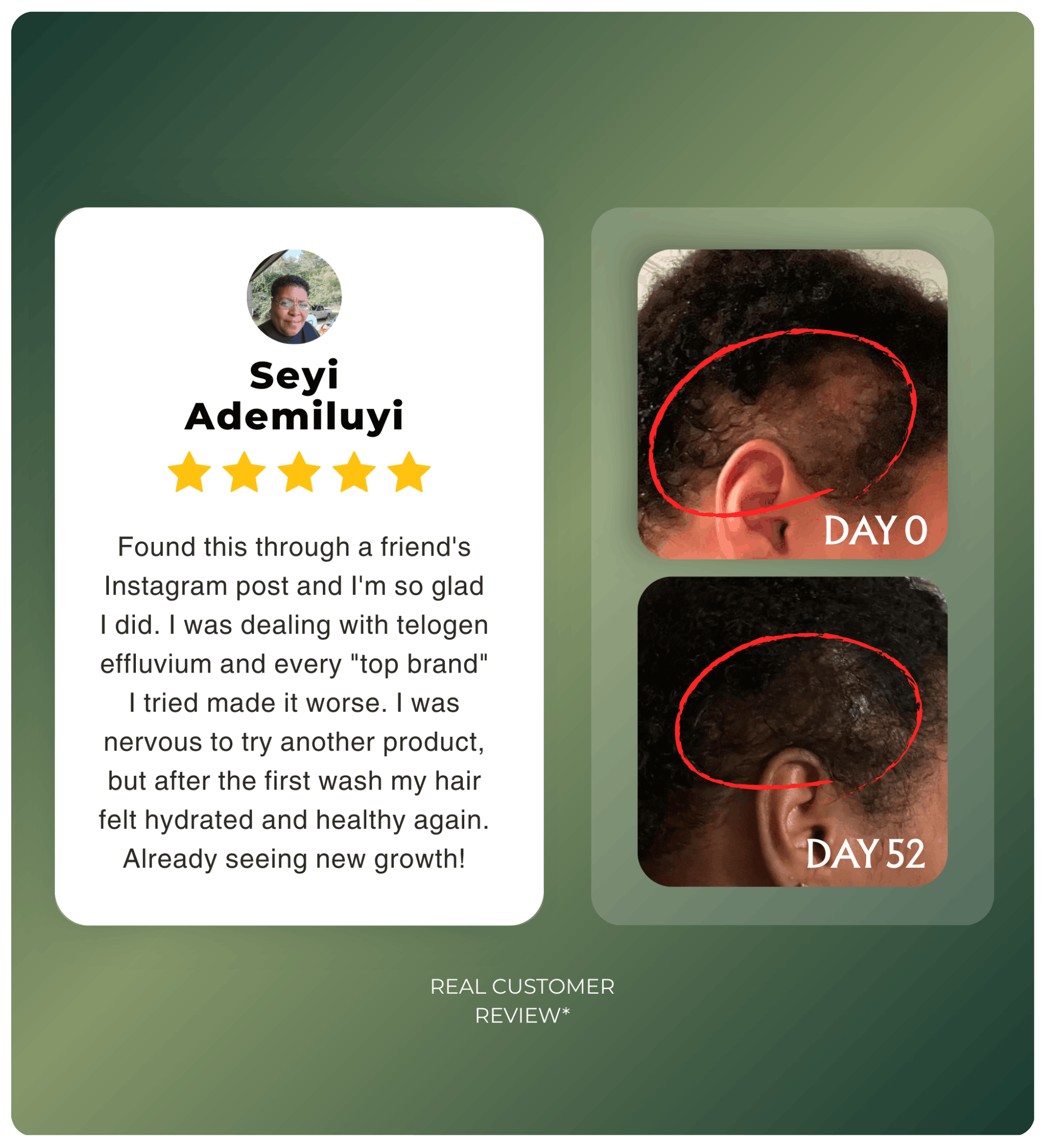 Authentic Hand-Extracted Batana Oil For Scalp Care and Nourishment