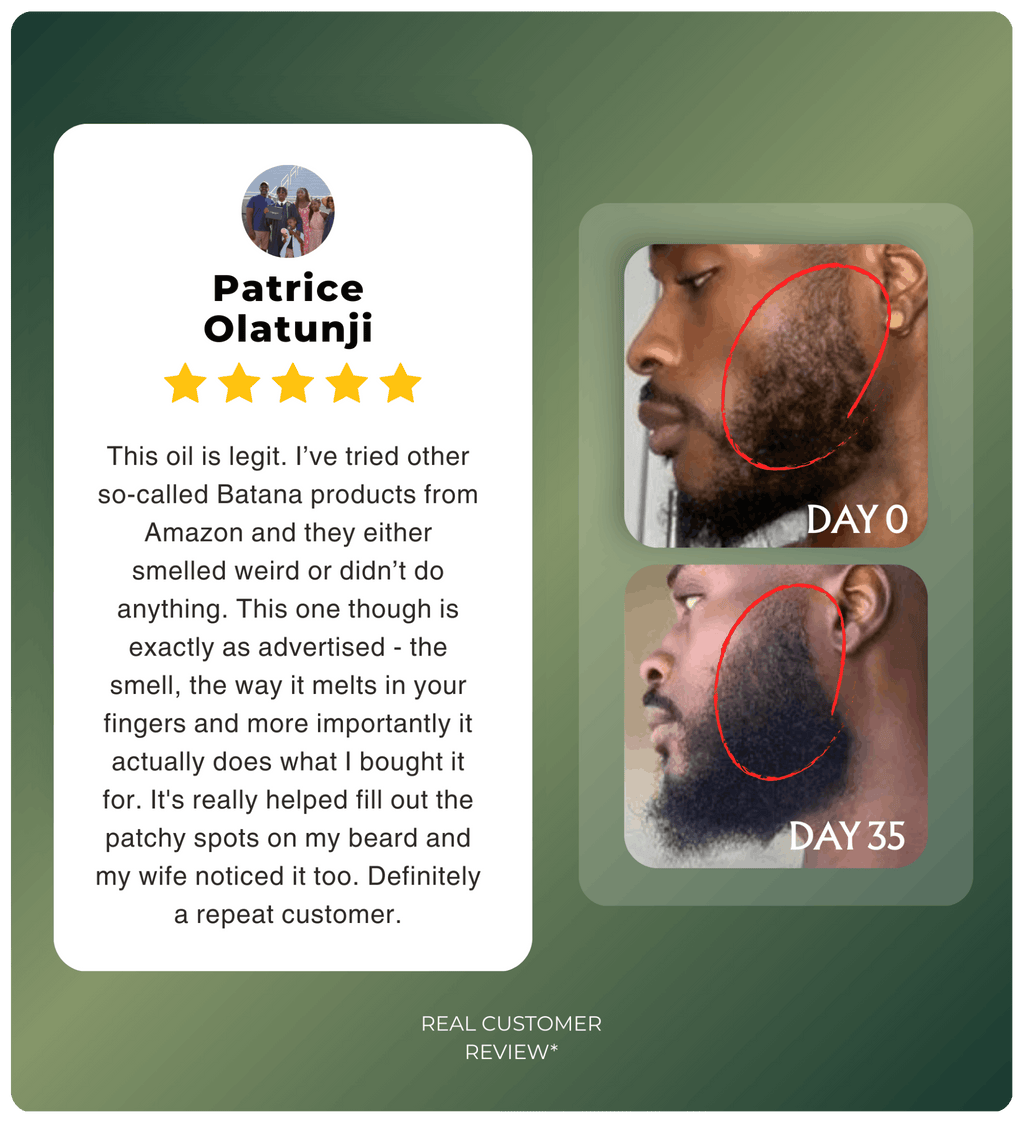 Authentic Hand-Extracted Batana Oil For Scalp Care and Nourishment