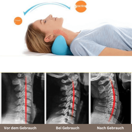 Ergonomic Neck Massage Pillow for Relaxation & Pain Relief - Fioriscas
