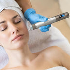 Hydra Pen H3 voor microneedling en seruminsluizing thuis | Fioriscas