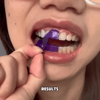 Purple PAP Whitening Strips for a Brighter Smile | Fioriscas