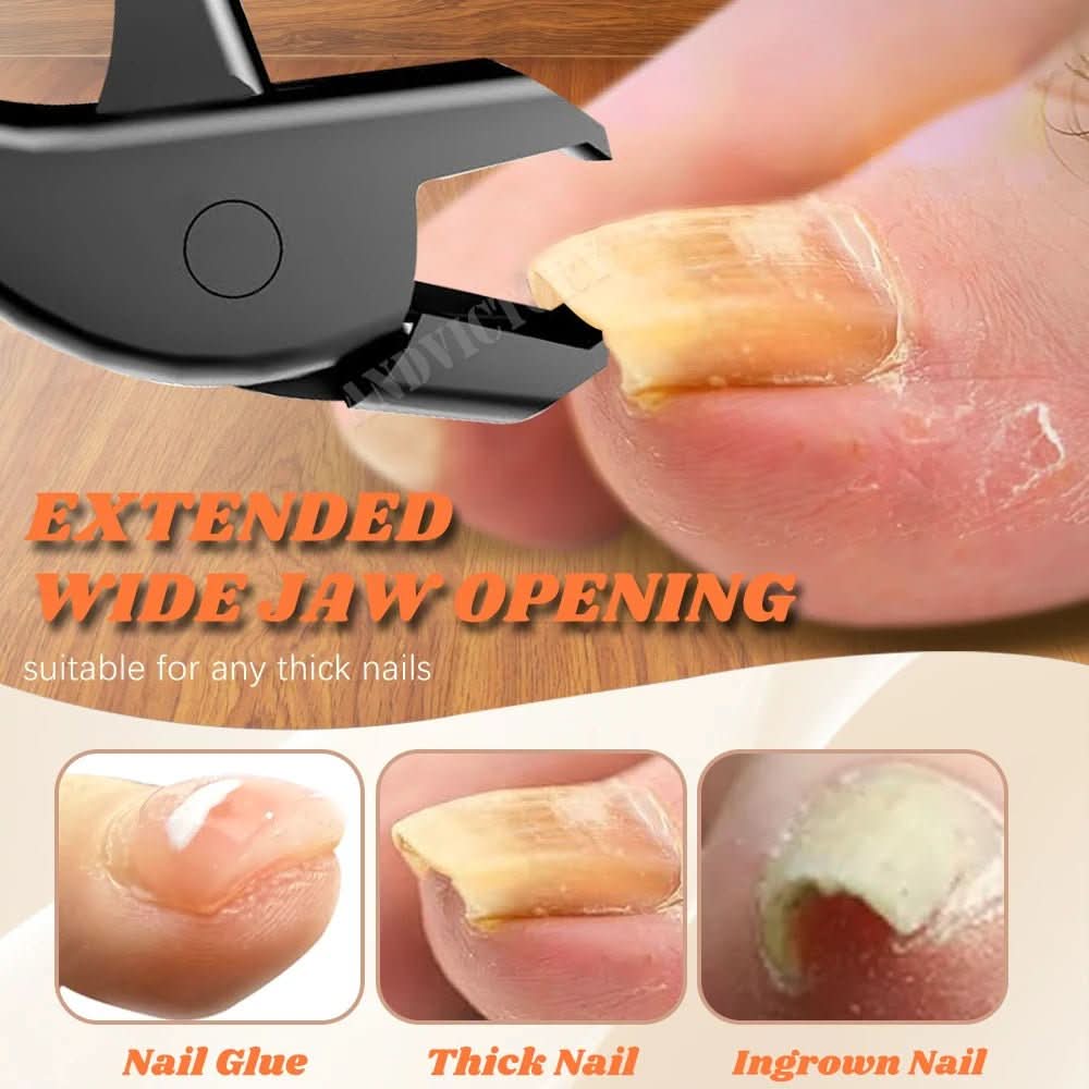 Precision Nail Clipper for Effortless Care - Fioriscas