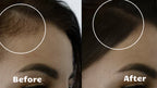 Light Wave Red Light Hair Growth Device Helps Thinning Hair | Fioriscas