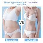All-In-One Ultrasonic Cavitation Enhanced RF For Body Contouring Device With EMS Vacuum