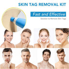 Painless skin tag removal for neck, back & body - Fioriscas