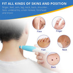 Painless skin tag removal for neck, back & body - Fioriscas