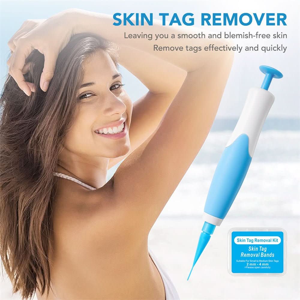 Painless skin tag removal for neck, back & body - Fioriscas