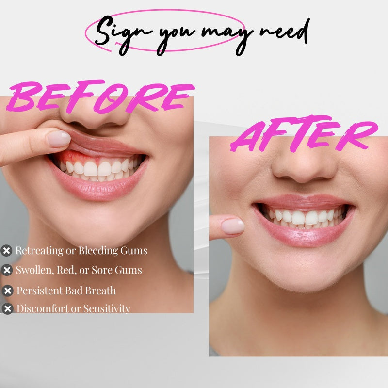 Dispositivo per la cura di gengive e denti con luce rossa e luce blu