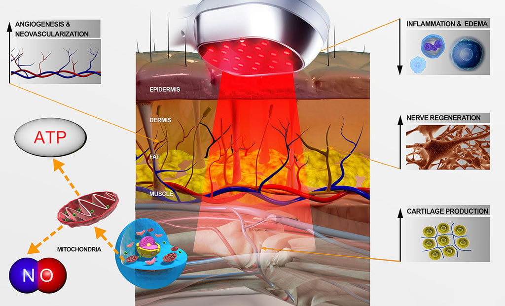 Soulagement des douleurs à domicile avec appareil laser froid à double longueur d’onde amélioré | Fioriscas