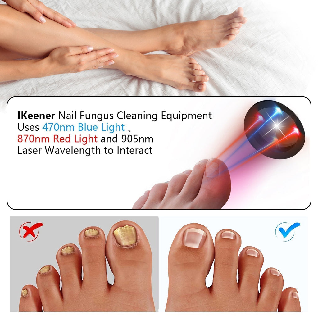 ApexNova Laser Nail System For Simple At-Home Care And DIY Maintenance