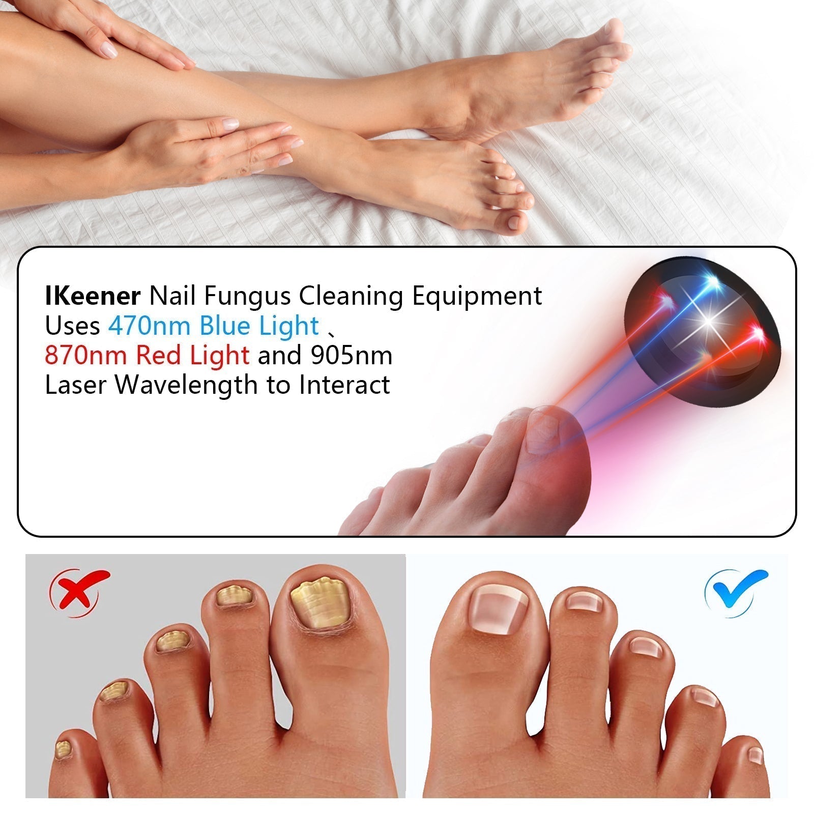 ApexNova Laser Nail System For Simple At-Home Care And DIY Maintenance
