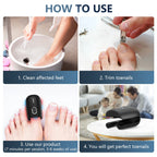 ApexNova Laser Nail System For Simple At-Home Care And DIY Maintenance