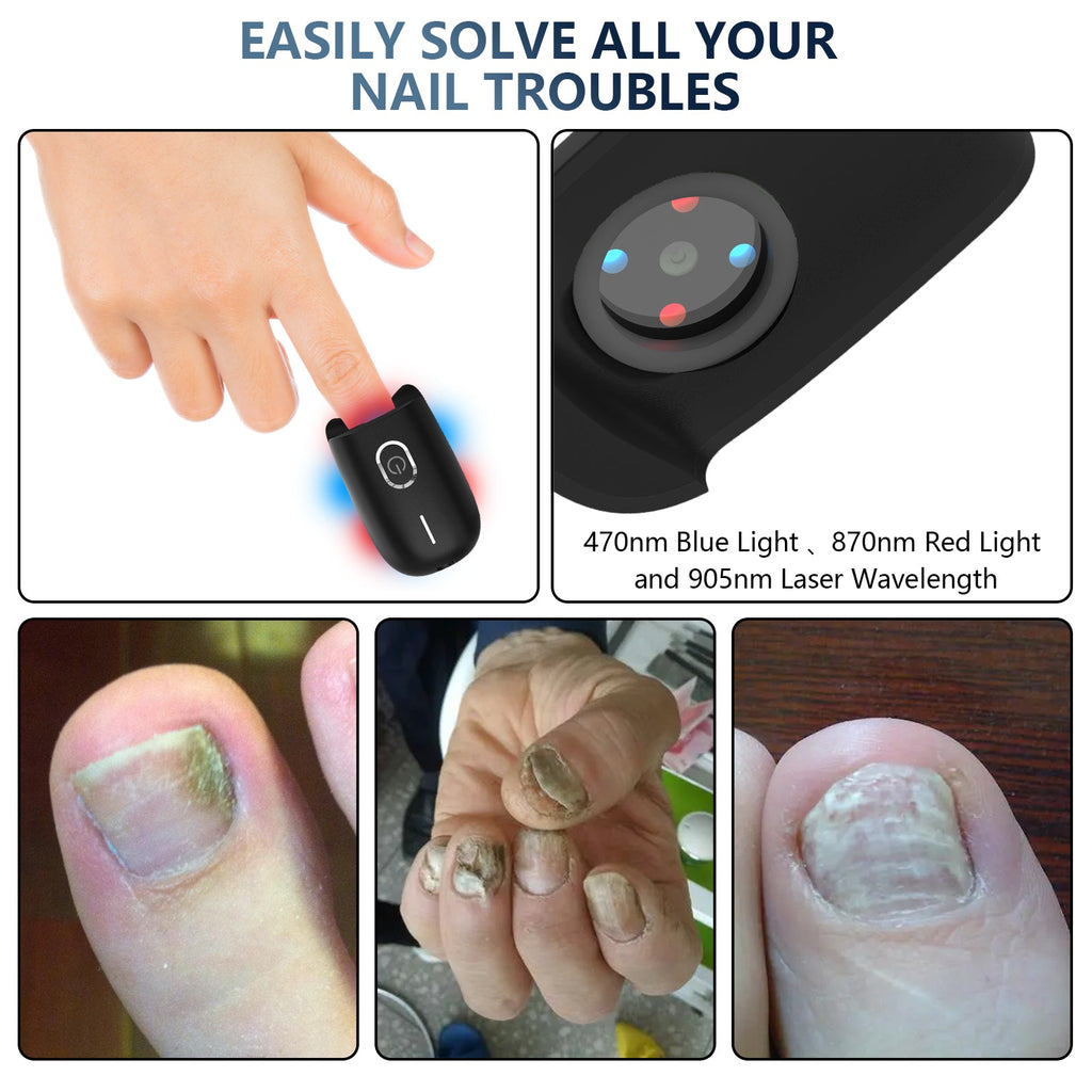 ApexNova Laser Nail System For Simple At-Home Care And DIY Maintenance